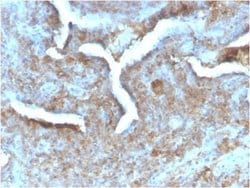 PD-ECGF/Thymidine Phosphorylase Antibody (TYMP/2890R) - Azide and BSA Free,